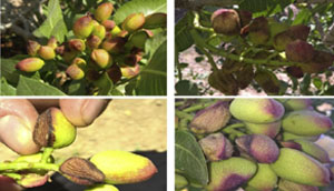 عارضه لکه پوست استخوانی